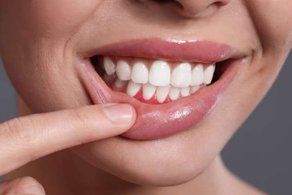 How Does A Dentist Approach Gum Disease Treatment?